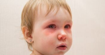 Augenkrankheiten bei Kindern: Rechtzeitige Diagnose sorgt für eine gesunde Entwicklung