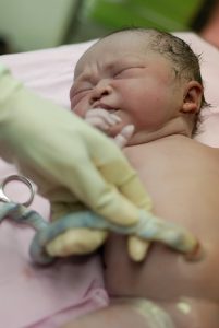 frischgeborenes Baby: Jetzt sollten die Eltern schon eine Entscheidung getroffen haben