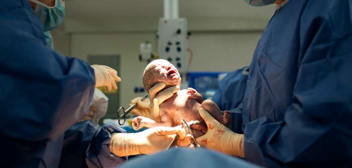 Nach & während der Geburt ( Foto: Adobe Stock - Martin Valigursky )