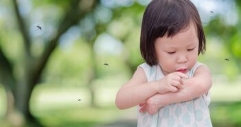 Neurodermitis bei Babys und Kleinkindern: Ursachen & Behandlung