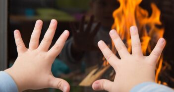 Verbrennungen behandeln: Verbrühungen & Verbrennungen bei Kindern