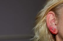 Allergie Piercing: Eine neue Möglichkeit zur Linderung von Allergiesymptomen (Foto: AdobeStock - 818930423 Claudia Evans)