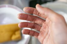 Waschmittel bei Allergien: Die beste Wahl für sensible Haut (Foto: AdobeStock - 649129151 wachiwit)